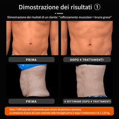 Macchina EMS NEO per Modellamento del Corpo e Snellimento, con Due Maniglie, Design da Scrivania per Uso Domestico