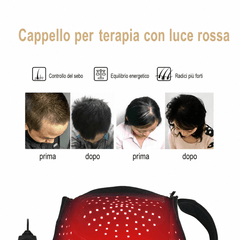 Cappello a LED Rosso per la Ricrescita dei Capelli 216 LED – Doppia Lunghezza d’Onda 660nm & 850nm