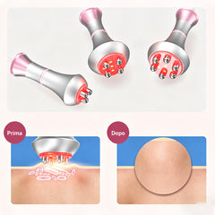 6in1 80K Dispositivo di Cavitazione a Radiofrequenza, con Piastra Lipolaser, Sistema Ultrasuono per Snellimento del Corpo, Massaggiatore Corpo per Bruciare Grassi e Cellulite