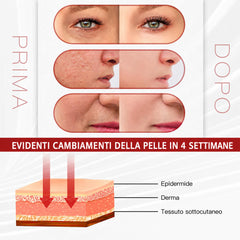 Macchina per la Cura del Viso con Terapia della Luce LED a 6 Colori e Modalità Ciclo di Colori, 178 Perline Luminose, Strumento di Bellezza con Luce PDT