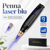 Penna Laser a Picosecondi FacialPure Lite con Luce Blu – Anti Macchie e Lentiggini per il Viso