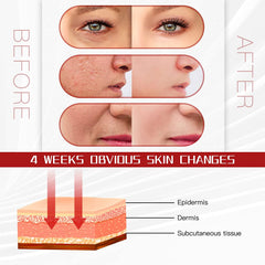 Macchina per la Cura del Viso con Terapia della Luce LED a 6 Colori e Modalità Ciclo di Colori, 178 Perline Luminose, Strumento di Bellezza con Luce PDT