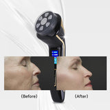 HIFU - FacialDefy 2.0, Dispositivo HIFU Portatile 4 in 1 a Ultrasuoni Microfocalizzati, Potenza Potenziata, Lifting Più Rapido, Risultati Visibili