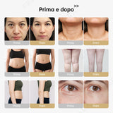 4in1 40K Radiofrequenza Ultrasuoni Cavitazione Macchina, Bruciare Grasso, Apparecchio Dimagrante del Corpo per Viso, Braccio, Vita, Pancia, Gamba