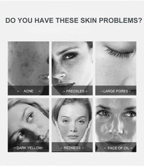 Dispositivo di Bellezza con Terapia a Luce LED a 7 Colori, 225 Perle di Luce, Strumento di Bellezza PDT Fotodinamico