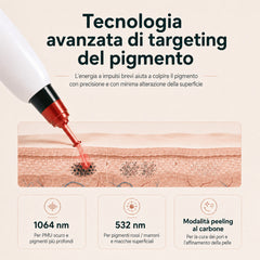 LASER FacialPure 4.0, Macchina Portatile Picosecondi Non Invasiva Con Trolley Piccolo, Rimozione Tatuaggi E Depilazione Sopracciglia