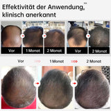 Cappello Laser LLLT per Ricrescita dei Capelli – Energia Focalizzata per Stimolare i Follicoli (5-8 mm)