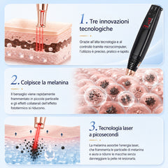 Penna Laser a Picosecondi FacialPure Lite con Luce Rossa – Anti Macchie e Lentiggini per il Viso