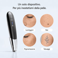 LASER FacialPure LS008 – Penna Laser Picosecondi per Uso Domestico con Posizionamento Luce Blu, Adatta per Rimozione Lentiggini, Sopracciglia Tattoo, Tatuaggi e Schiarimento Pigmenti