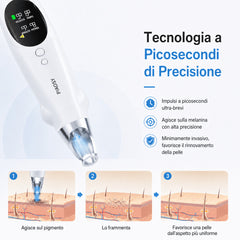 Penna Laser a Picosecondi per Uso Domestico – Dispositivo Wireless per Rimozione Tatuaggi e Macchie della Pelle con Puntamento a Luce Blu