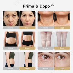 4in1 40K Radiofrequenza Ultrasuoni Cavitazione Macchina, Bruciare Grasso, Apparecchio Dimagrante del Corpo per Viso, Braccio, Vita, Pancia, Gamba