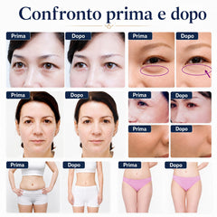 Mini 3in1 RF Dispositivo di bellezza Ringiovanimento Lifting Rimozione delle rughe Rassodamento della pelle per viso e occhi