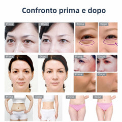 Mini 3in1 RF Dispositivo di bellezza Ringiovanimento Lifting Rimozione delle rughe Rassodamento della pelle per viso e occhi